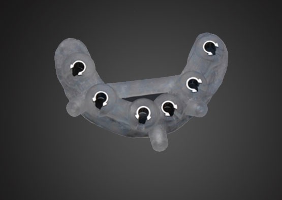 Digital implant surgical stent