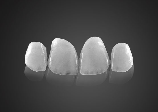 Yimei ultra-thin Venee