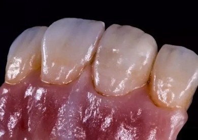 German Amanjilbach Zirconia